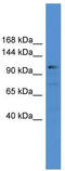 Ubiquitin carboxyl-terminal hydrolase 35 antibody, TA342574, Origene, Western Blot image 