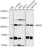 Protein Kinase D2 antibody, 18-036, ProSci, Western Blot image 