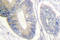 ShcA antibody, LS-C176299, Lifespan Biosciences, Immunohistochemistry paraffin image 