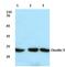 Claudin 5 antibody, A03260S201, Boster Biological Technology, Western Blot image 