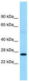 Ferritin, mitochondrial antibody, TA331204, Origene, Western Blot image 