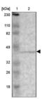 Zinc Finger Protein 222 antibody, NBP1-86148, Novus Biologicals, Western Blot image 