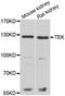 TEK Receptor Tyrosine Kinase antibody, A01274, Boster Biological Technology, Western Blot image 