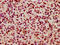 Kinesin Family Member 3C antibody, LS-C680719, Lifespan Biosciences, Immunohistochemistry paraffin image 
