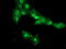 PHD Finger Protein 7 antibody, LS-C337817, Lifespan Biosciences, Immunofluorescence image 