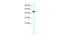 Zinc Finger Protein 239 antibody, 28-352, ProSci, Western Blot image 