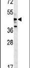 Serine/threonine-protein kinase NLK antibody, PA5-25953, Invitrogen Antibodies, Western Blot image 