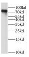 Kntc2 antibody, FNab05599, FineTest, Western Blot image 