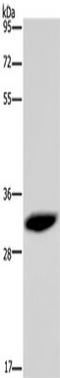 High mobility group nucleosome-binding domain-containing protein 5 antibody, TA350239, Origene, Western Blot image 