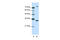 Exosome complex exonuclease RRP4 antibody, 29-419, ProSci, Western Blot image 