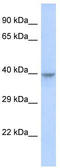 Dachshund Family Transcription Factor 2 antibody, TA330533, Origene, Western Blot image 