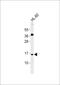 ATP Synthase Membrane Subunit F antibody, PA5-72418, Invitrogen Antibodies, Western Blot image 