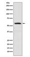 Internexin Neuronal Intermediate Filament Protein Alpha antibody, M03756, Boster Biological Technology, Western Blot image 