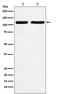 Spectrin Repeat Containing Nuclear Envelope Protein 1 antibody, M02192, Boster Biological Technology, Western Blot image 