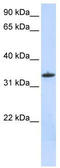 Mitochondrial Ribosomal Protein L19 antibody, TA339312, Origene, Western Blot image 