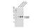 Sodium channel subunit beta-1 antibody, 14684S, Cell Signaling Technology, Western Blot image 