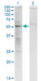 SS18 Subunit Of BAF Chromatin Remodeling Complex antibody, LS-C198270, Lifespan Biosciences, Western Blot image 