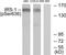 Insulin Receptor Substrate 1 antibody, TA312871, Origene, Western Blot image 