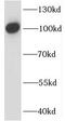 Interleukin 12 Receptor Subunit Beta 1 antibody, FNab04220, FineTest, Western Blot image 
