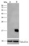 Prdx6 antibody, GTX01996, GeneTex, Western Blot image 