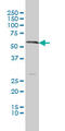Solute Carrier Family 18 Member A1 antibody, LS-C198218, Lifespan Biosciences, Western Blot image 