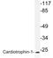 Cardiotrophin-1 antibody, LS-C291677, Lifespan Biosciences, Western Blot image 
