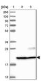Chromosome 9 Open Reading Frame 40 antibody, PA5-59900, Invitrogen Antibodies, Western Blot image 