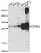 Crystallin Beta B2 antibody, STJ27543, St John