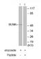 BLNK antibody, ab73706, Abcam, Western Blot image 