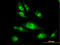 Proteasome 26S Subunit, ATPase 4 antibody, LS-C133417, Lifespan Biosciences, Immunofluorescence image 