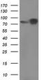 CTNNB1 antibody, TA502341BM, Origene, Western Blot image 