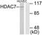 Histone Deacetylase 7 antibody, TA315483, Origene, Western Blot image 