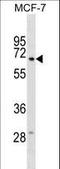 Gamma-Glutamyltransferase 6 antibody, LS-C159726, Lifespan Biosciences, Western Blot image 