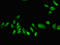 Homeobox protein CDX-1 antibody, LS-C677482, Lifespan Biosciences, Immunofluorescence image 