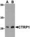 CTRP1 antibody, MBS150539, MyBioSource, Western Blot image 