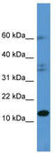 Histidine Triad Nucleotide Binding Protein 2 antibody, TA342891, Origene, Western Blot image 