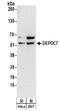 DEP Domain Containing 7 antibody, NBP2-32141, Novus Biologicals, Western Blot image 