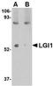 Leucine Rich Glioma Inactivated 1 antibody, NBP1-76379, Novus Biologicals, Western Blot image 