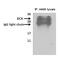Deoxycytidine Kinase antibody, 62-650, ProSci, Immunoprecipitation image 