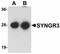 Synaptogyrin 3 antibody, orb94360, Biorbyt, Western Blot image 