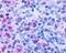 Cysteinyl Leukotriene Receptor 1 antibody, NLS1317, Novus Biologicals, Immunohistochemistry frozen image 