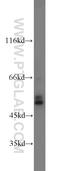 Carboxypeptidase E antibody, 13710-1-AP, Proteintech Group, Western Blot image 