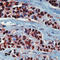 Heat shock protein HSP 90-alpha antibody, LS-C88628, Lifespan Biosciences, Immunohistochemistry paraffin image 