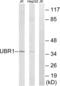 Ubiquitin Protein Ligase E3 Component N-Recognin 1 antibody, abx014447, Abbexa, Western Blot image 