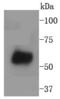 WASP Family Member 2 antibody, A03969-2, Boster Biological Technology, Western Blot image 