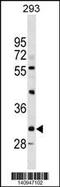 Uncoupling Protein 1 antibody, LS-C157015, Lifespan Biosciences, Western Blot image 