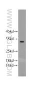 TLC Domain Ceramide Synthase 3B antibody, 20760-1-AP, Proteintech Group, Western Blot image 