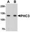 Polyhomeotic Homolog 3 antibody, A08917, Boster Biological Technology, Western Blot image 