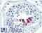Cyclin D1 antibody, LS-B3452, Lifespan Biosciences, Immunohistochemistry paraffin image 
