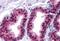 Cyclin Dependent Kinase Inhibitor 1B antibody, MBS244971, MyBioSource, Immunohistochemistry paraffin image 